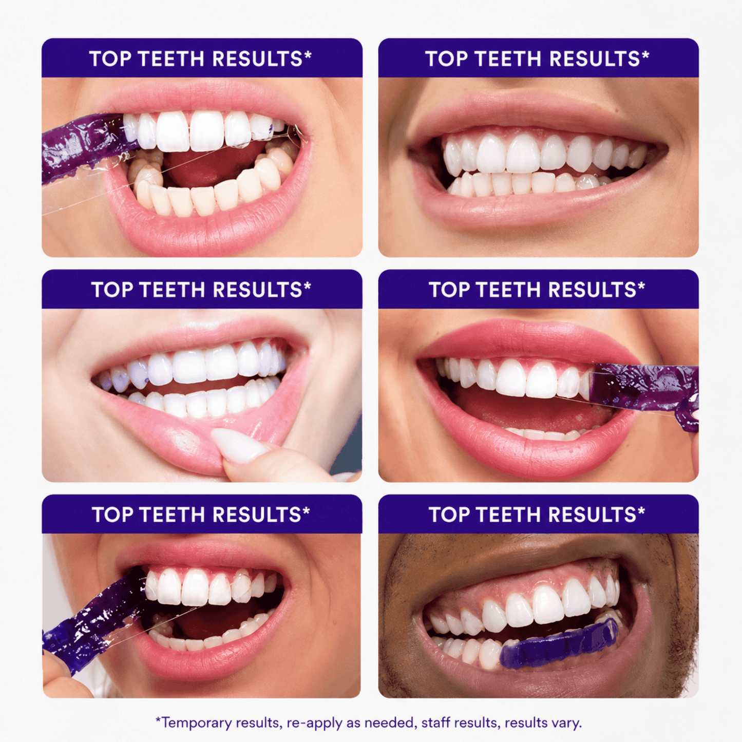 Purple Whitening Strips